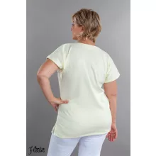 Halványsárga pamut felső, női tunika munkaruha egészségügyi és óvodai dolgozóknak